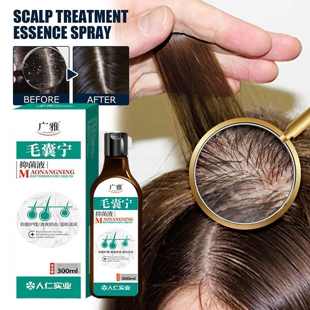 Anti-Dandruff Anti-Itch Shampoo Chinese Herbal Hair Care Mite Folliculitis Seborrheic Scalp Dry Shampoo
Anti-Dandruff Anti-Itch Shampoo Chinese Herbal Hair Care Mite Folliculitis Seborrheic Scalp Dry Shampoo