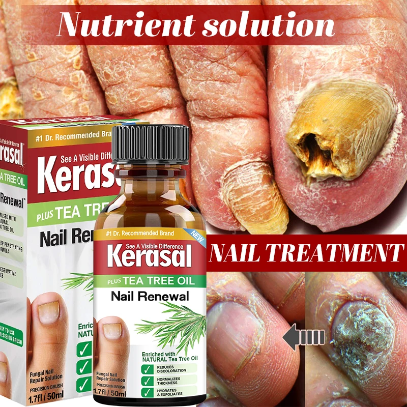 Fungal Nail Treatment Essential oil Hand and Foot Whitening Toe Nail Fungus Removal Infection Feet Care Polish Nail Gel 50ml
Fungal Nail Treatment Essential oil Hand and Foot Whitening Toe Nail Fungus Removal Infection Feet Care Polish Nail Gel 50ml