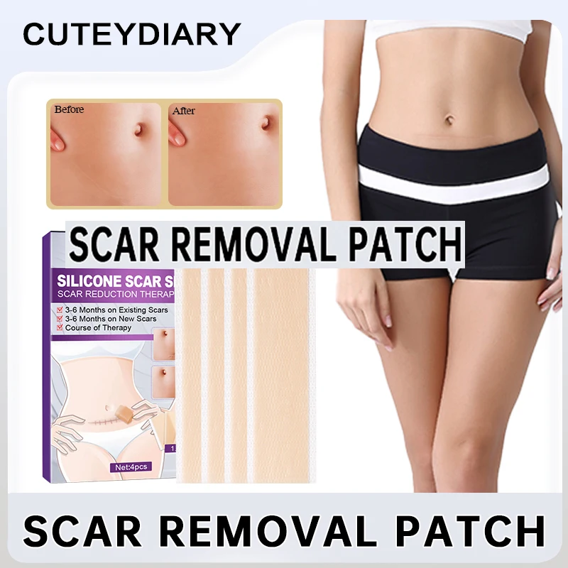 Silicone Scar Sheet Highly Effective Cosmetic Tape Silicone Gel Scar Removal Tape For Acne Burns C-section Scars Treatment
Silicone Scar Sheet Highly Effective Cosmetic Tape Silicone Gel Scar Removal Tape For Acne Burns C-section Scars Treatment