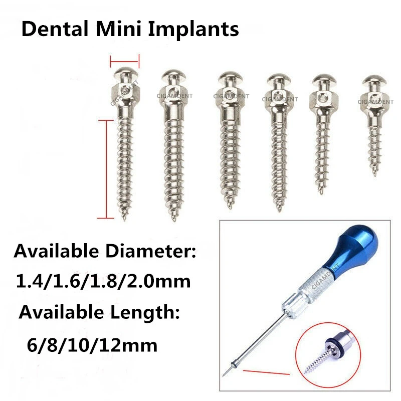 13 Size Dental Orthodontic Mini Implant Micro Screw Driver Titanium Alloy Dental Implant Screwdriver
13 Size Dental Orthodontic Mini Implant Micro Screw Driver Titanium Alloy Dental Implant Screwdriver