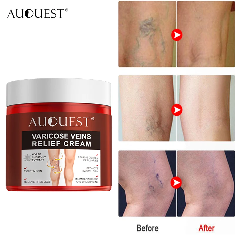 AUQUEST 80g Varicose Veins Treatment Cream Relieve Tired Legs Dilated Vasculitis Phlebitis Spider Pain Relief Ointment Body Care
AUQUEST 80g Varicose Veins Treatment Cream Relieve Tired Legs Dilated Vasculitis Phlebitis Spider Pain Relief Ointment Body Care