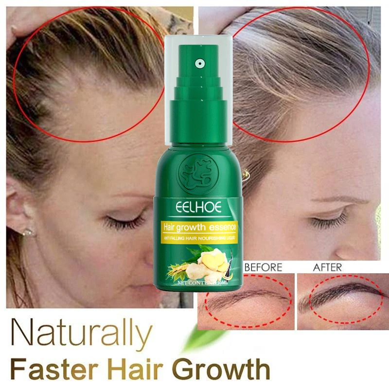 Ginger Hair Growth Essence Spray Anti Hairs Loss Products Effective Fast Growing Serum Scalp Treatment For Men Women Hair Care
Ginger Hair Growth Essence Spray Anti Hairs Loss Products Effective Fast Growing Serum Scalp Treatment For Men Women Hair Care