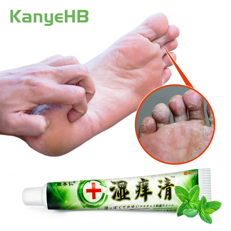 1pcs Tinea Pedis Ointment Beriberi Medical Cream Mint Cooling Anti-itch Inhibit Fungi Cream Foot Odor Toes Skin Erosion S052
1pcs Tinea Pedis Ointment Beriberi Medical Cream Mint Cooling Anti-itch Inhibit Fungi Cream Foot Odor Toes Skin Erosion S052