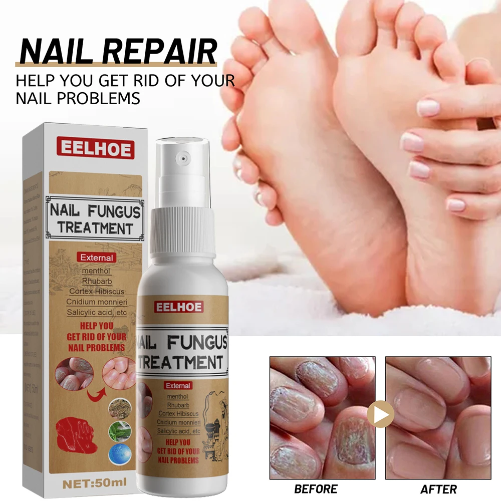 Newly Herbal Essence Antibacterial Nail Treatments Spary Nails Fungus Repair for Women Men Foot Nail Care Product 50ml
Newly Herbal Essence Antibacterial Nail Treatments Spary Nails Fungus Repair for Women Men Foot Nail Care Product 50ml