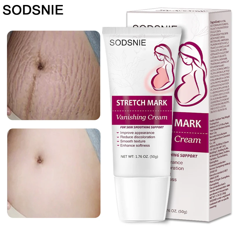 Pregnancy Repair Cream Stretch Mark Removal Anti-Wrinkle Anti-Aging Fade Acne Scar Burn Scars Vitamin E Beauty Skin Care Product
Pregnancy Repair Cream Stretch Mark Removal Anti-Wrinkle Anti-Aging Fade Acne Scar Burn Scars Vitamin E Beauty Skin Care Product