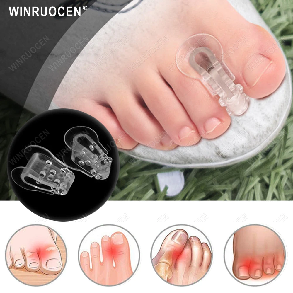 2pcs Silicone Toe Separator Insoles Ring Separation Hallux Valgus Correction Pad Thumb Orthotics Corrector Foot Care Tools
2pcs Silicone Toe Separator Insoles Ring Separation Hallux Valgus Correction Pad Thumb Orthotics Corrector Foot Care Tools