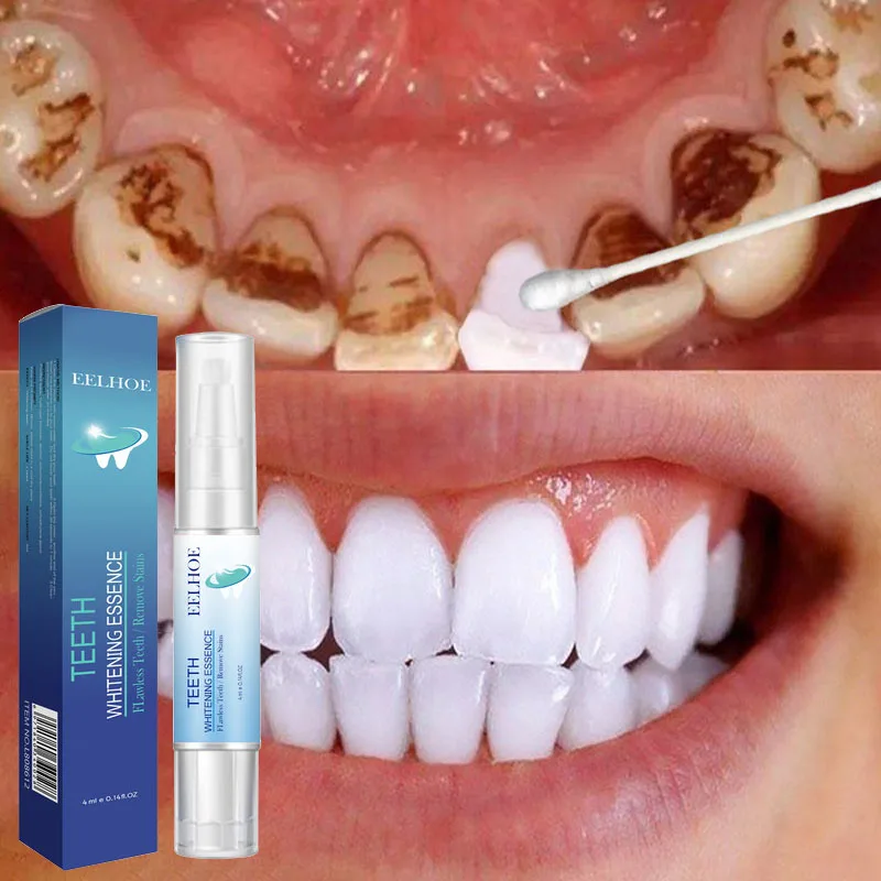 

Teeth Whitening Pen Essence Removes Plaque Stains Tooth Bleaching Cleaning Serum Teeth Whitener Hygiene Tooth Whitening Pen