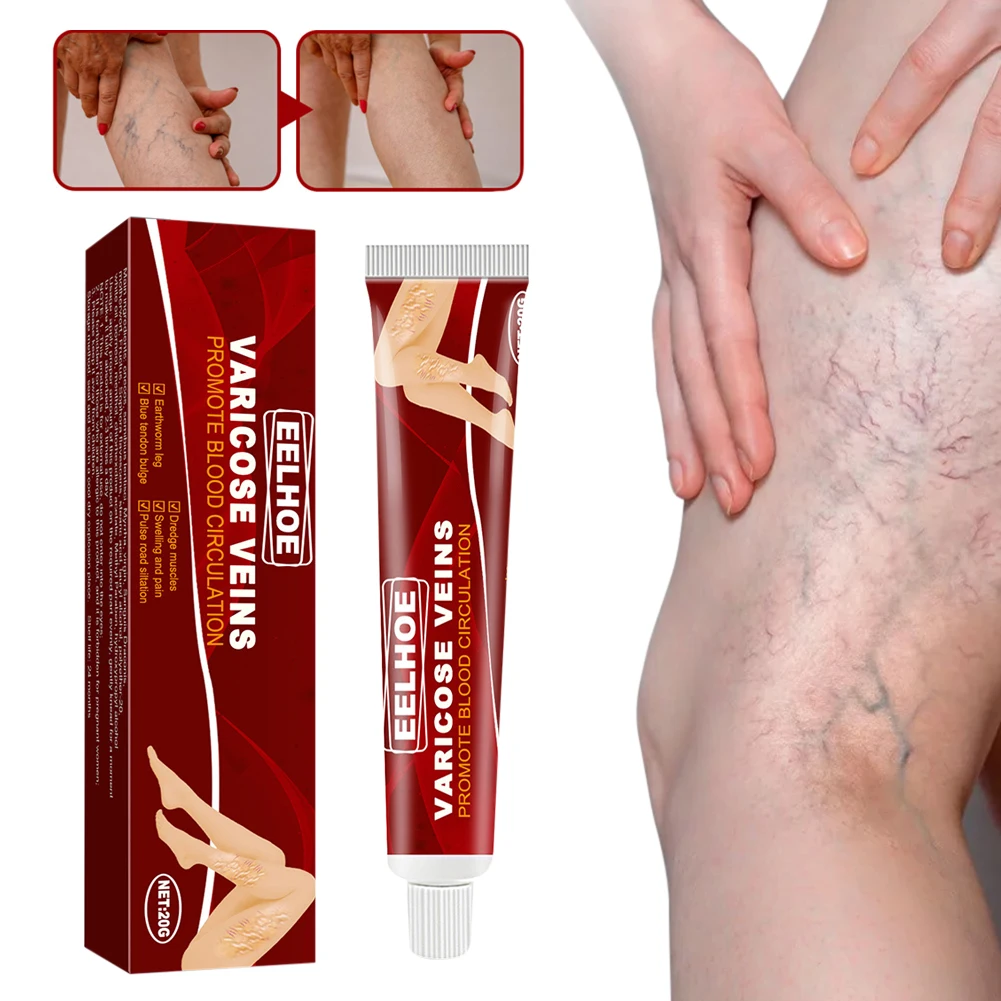 20g Varicose Veins Treatment Cream Vasculitis Phlebitis Spider Pain Relief Ointment Angiitis Plaster Foot Body Health Care Cream
20g Varicose Veins Treatment Cream Vasculitis Phlebitis Spider Pain Relief Ointment Angiitis Plaster Foot Body Health Care Cream