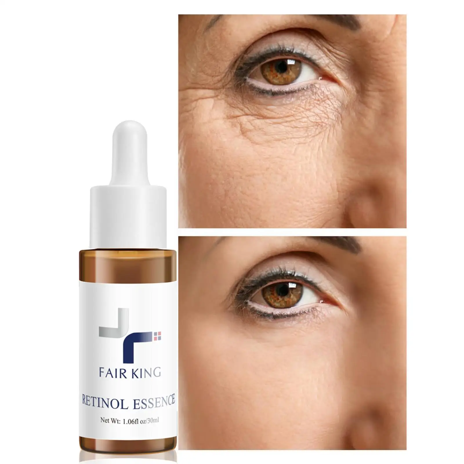 Отбеливающая антивозрастная Сыворотка с витамином, 30 мл
Отбеливающая антивозрастная Сыворотка с витамином, 30 мл