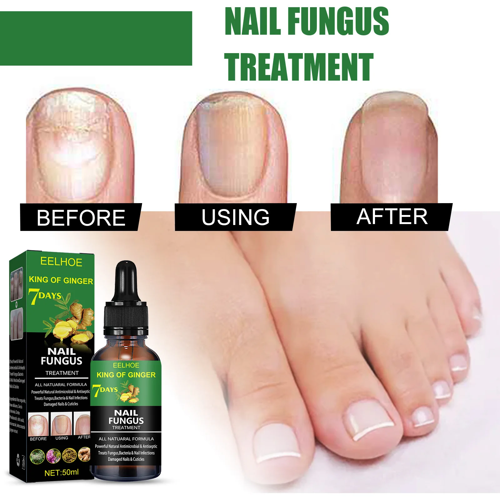 50ml Ginger Toenail Nail Treatments Repair Essence Feet Care Serum Foot Toe Fungal Removal Gel Anti Infection Onychomycosis
50ml Ginger Toenail Nail Treatments Repair Essence Feet Care Serum Foot Toe Fungal Removal Gel Anti Infection Onychomycosis