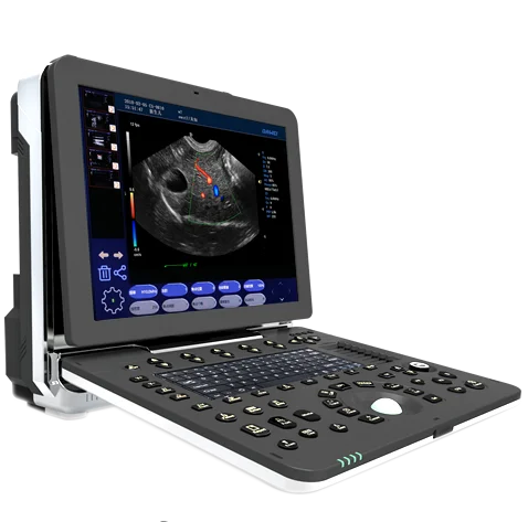 laptop portable animals ultrasound/ Veterinary Ultrasound Machine/Vet Handheld Ultrasound Scanner mindray ultrasound machine
laptop portable animals ultrasound/ Veterinary Ultrasound Machine/Vet Handheld Ultrasound Scanner mindray ultrasound machine