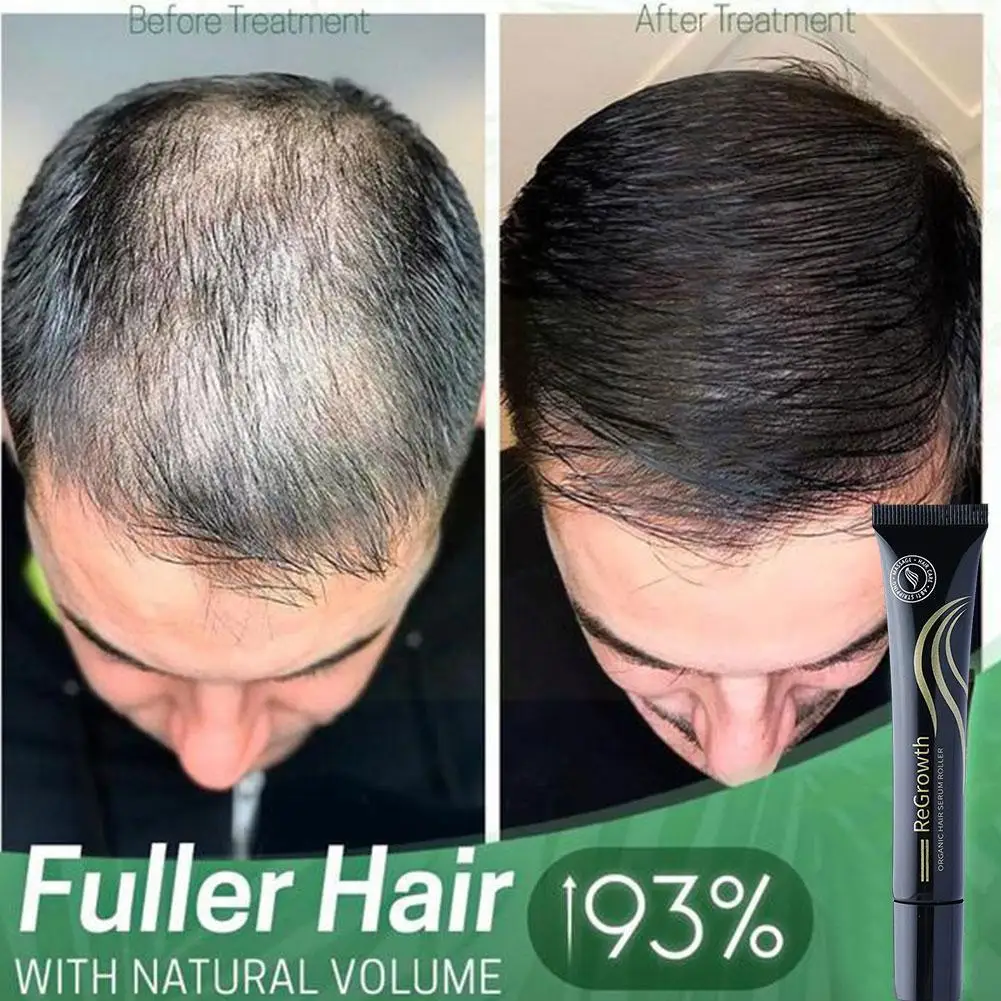 Ginger Serum Roller Hair Hair Growth Essential Oil Products Loss 20ml Hair Hair Growth Care Hair Massage Essence M0p3
Ginger Serum Roller Hair Hair Growth Essential Oil Products Loss 20ml Hair Hair Growth Care Hair Massage Essence M0p3