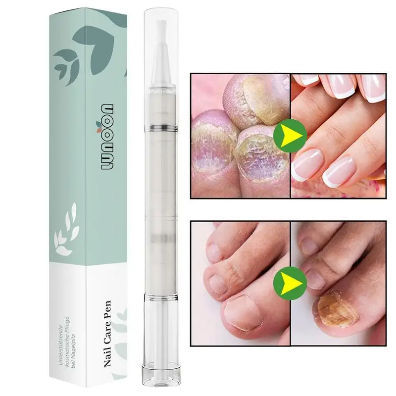 

Nail Repair Pen 4ml Portable Nail Care Solution Toenail Renewal Solution For Damaged & Discoloration Toenail Or Fingernail