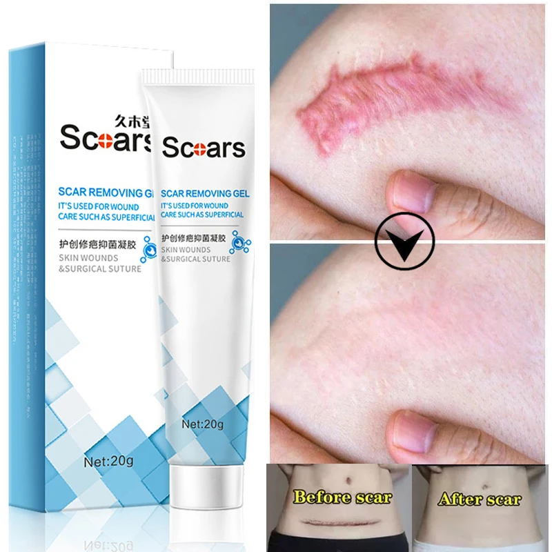 Herbal Scar Removal Cream Repairing Pock Mark Burn Surgical Scar Cesarean Old Scars Stretch Marks Gel Smooth Moisturizing Skin
Herbal Scar Removal Cream Repairing Pock Mark Burn Surgical Scar Cesarean Old Scars Stretch Marks Gel Smooth Moisturizing Skin