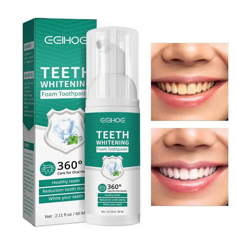 Teeth Whitening Foam Toothpaste 60ml White Teeth Mousse Teeth Cleaning Toothpaste Yellow Tooth Stain Removal Oral Care Toothpast
Teeth Whitening Foam Toothpaste 60ml White Teeth Mousse Teeth Cleaning Toothpaste Yellow Tooth Stain Removal Oral Care Toothpast