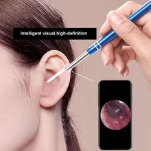 USB Phone Ear Otoscope Scope Inspection Camera 3in1 Ear Digital Endoscope Earwax Cleaner Tool For Android XIaomi Samsung Phone