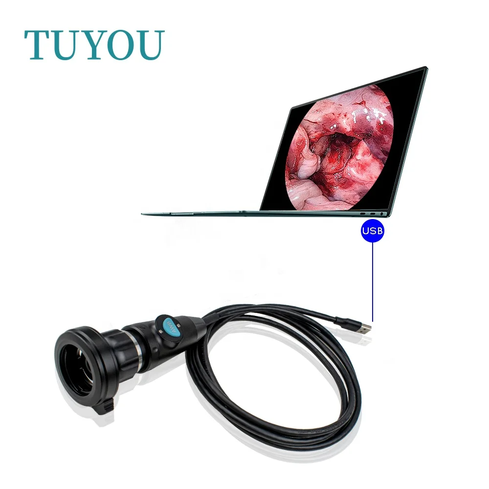 Portable USB endoscop camer with Medical Digital Surgical Fiberscope for ENT Nasal Otoscope
Portable USB endoscop camer with Medical Digital Surgical Fiberscope for ENT Nasal Otoscope