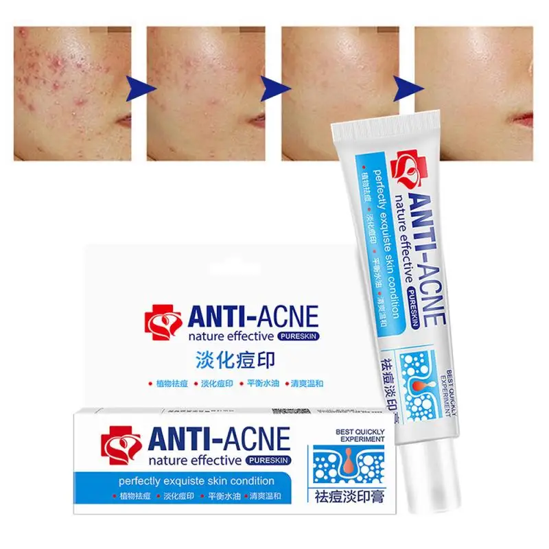 Herbal Anti Effective Acne Removal Cream Traditional Chinese Medicine Treatment Shrink Pores Spots Gel Whitening Moisturizing
Herbal Anti Effective Acne Removal Cream Traditional Chinese Medicine Treatment Shrink Pores Spots Gel Whitening Moisturizing