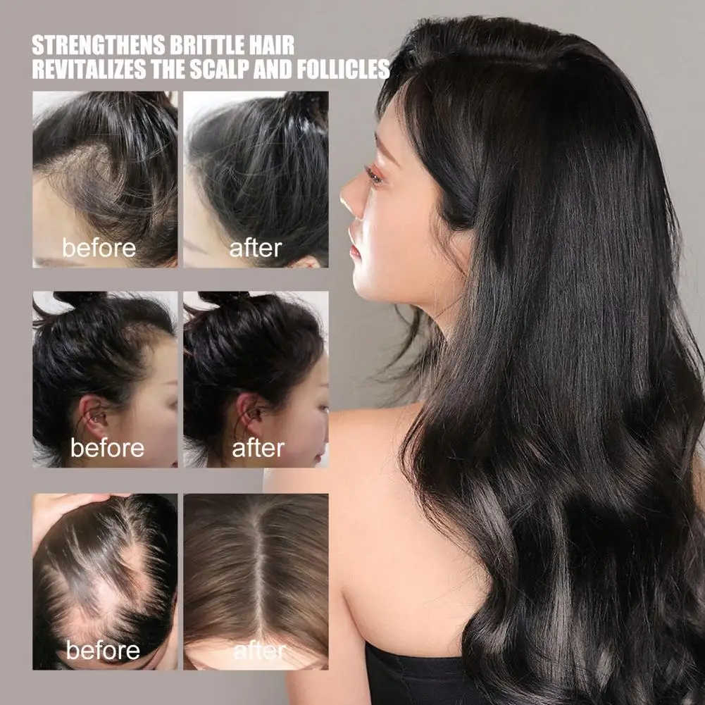Universal Hair Loss Treatment Essential Oil Hair Growth Oil Fast Absorbent Nourishing
Universal Hair Loss Treatment Essential Oil Hair Growth Oil Fast Absorbent Nourishing