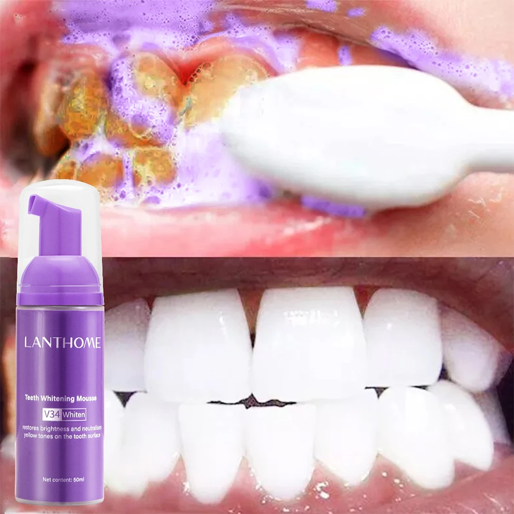 V34 Teeth Cleansing Whitening Mousse Removes Stains Teeth Whitening Oral Hygiene Mousse Toothpaste Whitening and Staining 50ml
V34 Teeth Cleansing Whitening Mousse Removes Stains Teeth Whitening Oral Hygiene Mousse Toothpaste Whitening and Staining 50ml