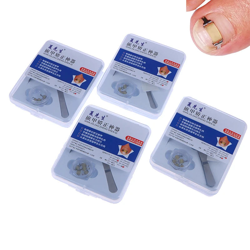 Ingrown Toenail Corrector Tools Pedicure Professional Ingrown Toenail Correction Foot Care Tool Recover Embed Toenail Treatment
Ingrown Toenail Corrector Tools Pedicure Professional Ingrown Toenail Correction Foot Care Tool Recover Embed Toenail Treatment
