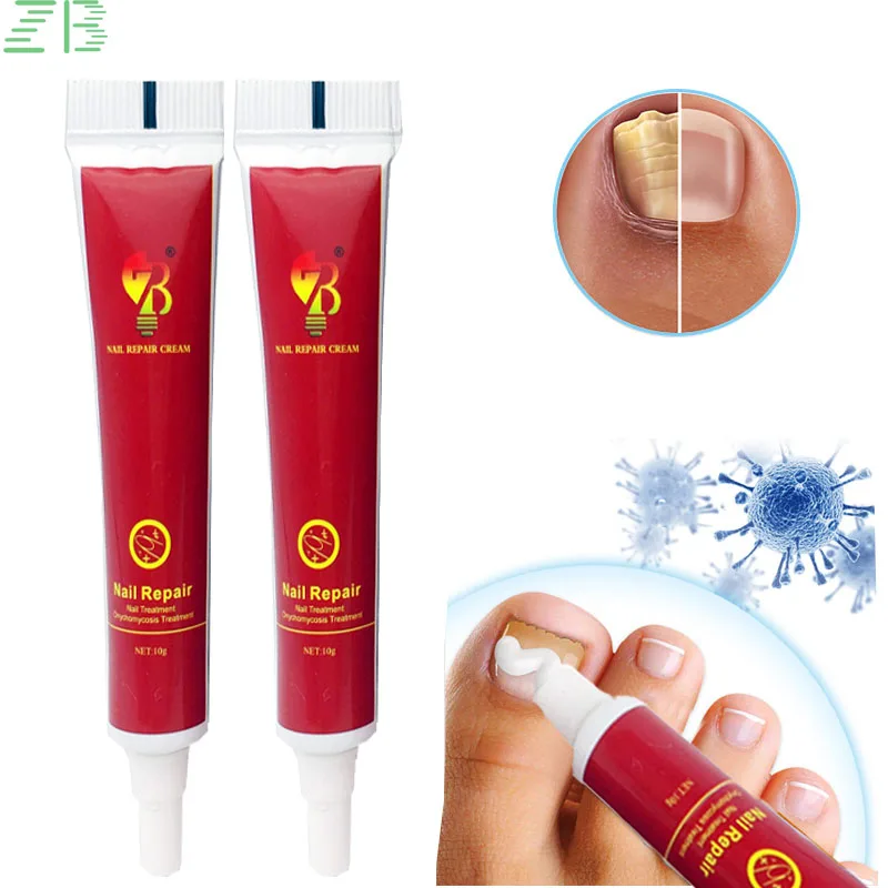 10g ZB Herbal Nail Repair Cream Treats Onychomycosis Paronychia Chinese Herbal Antifungal Nail Infection Medical Plaster
10g ZB Herbal Nail Repair Cream Treats Onychomycosis Paronychia Chinese Herbal Antifungal Nail Infection Medical Plaster