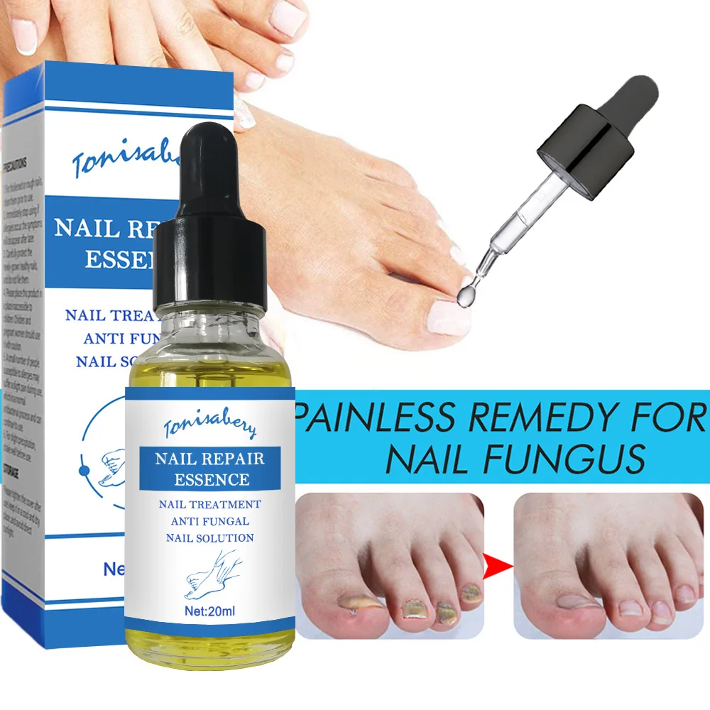 Nail Fungal Treatment Feet Care Essence Anti Infection Paronychia Onychomycosis Foot Toe Nail Fungus Removal Gel Products 20ml
Nail Fungal Treatment Feet Care Essence Anti Infection Paronychia Onychomycosis Foot Toe Nail Fungus Removal Gel Products 20ml