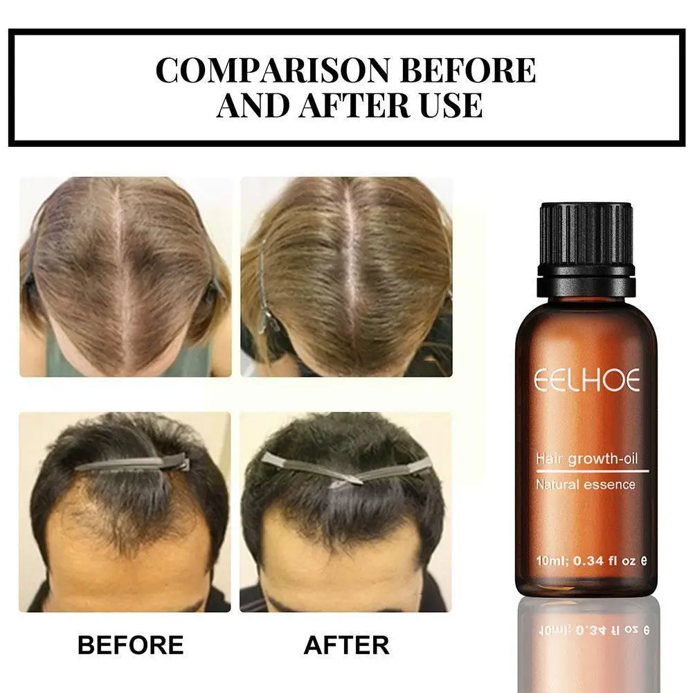 Hair Growth Products Ginger Essence Fast Regrowth Serum Beard Growth Oil Hair Loss Care Beauty Scalp Treatment For Men Wome V1f2
Hair Growth Products Ginger Essence Fast Regrowth Serum Beard Growth Oil Hair Loss Care Beauty Scalp Treatment For Men Wome V1f2