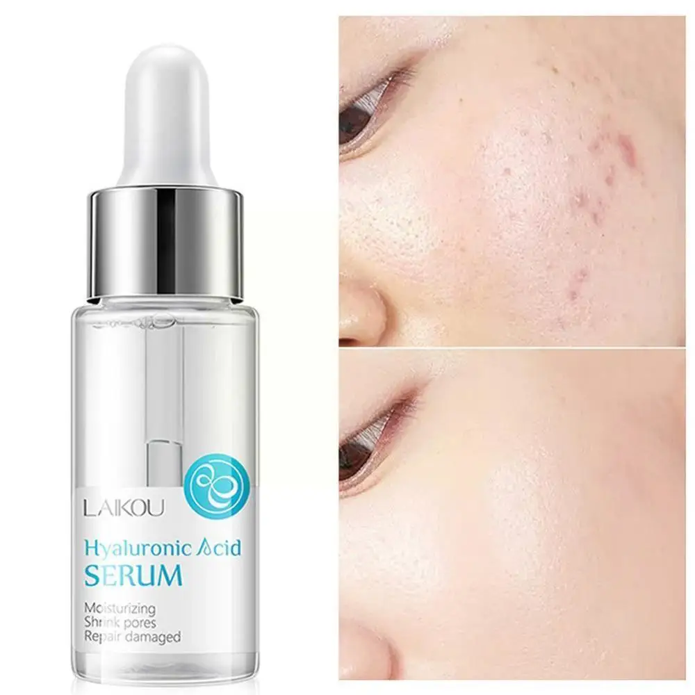 Hyaluronic Acid Shrink Pore Face Serum Moisturizing Dry Face New Skin Cream Care Whitening H9J8
Hyaluronic Acid Shrink Pore Face Serum Moisturizing Dry Face New Skin Cream Care Whitening H9J8