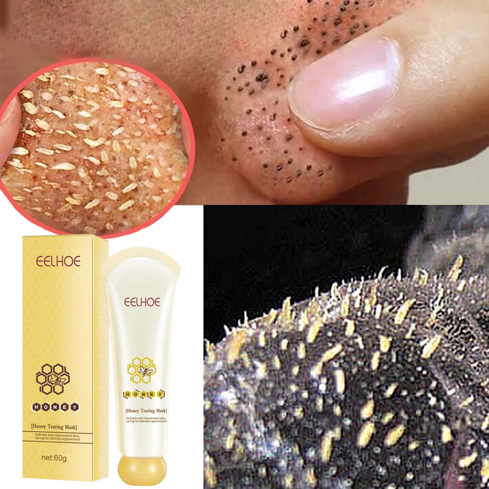 

Honey Blackhead Remover Peel Off Mask Fade Acne Black Dots Face Cleaning Pores Shrink Oil Control Whitening Moisturize Skin Care