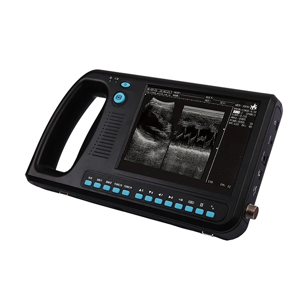 Palm Smart Handheld Ultrasound Scanner Portable B/W Digital Ultrasound Machine
Palm Smart Handheld Ultrasound Scanner Portable B/W Digital Ultrasound Machine