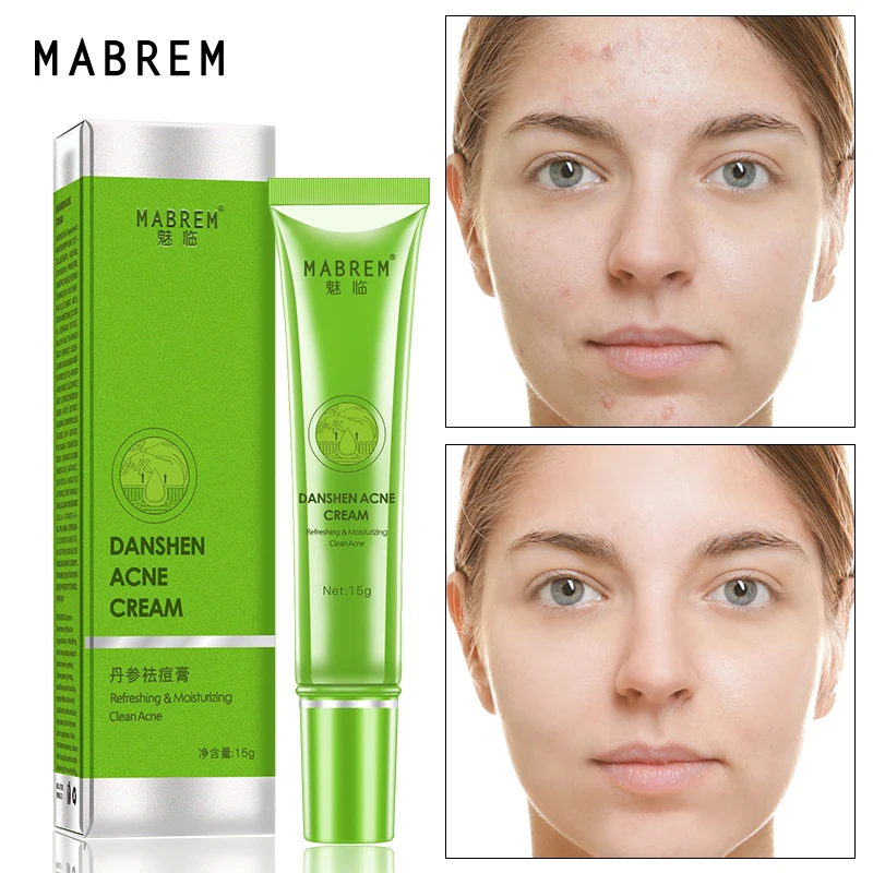 Effective Acne Removal Cream Acne Treatment Fade Acne Spots Oil Control Shrink Pores Whitening Moisturizing Acne Cream Skin Care
Effective Acne Removal Cream Acne Treatment Fade Acne Spots Oil Control Shrink Pores Whitening Moisturizing Acne Cream Skin Care