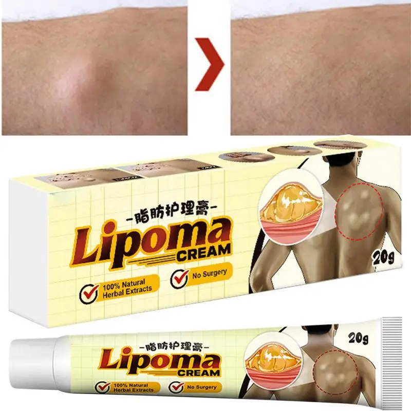 Lipoma Cream Herbal Ingredients Lipoma Lumps Removal Ointment Easy To Absorb Lipoma Removal Relieve Swelling And Varicose 
Lipoma Cream Herbal Ingredients Lipoma Lumps Removal Ointment Easy To Absorb Lipoma Removal Relieve Swelling And Varicose