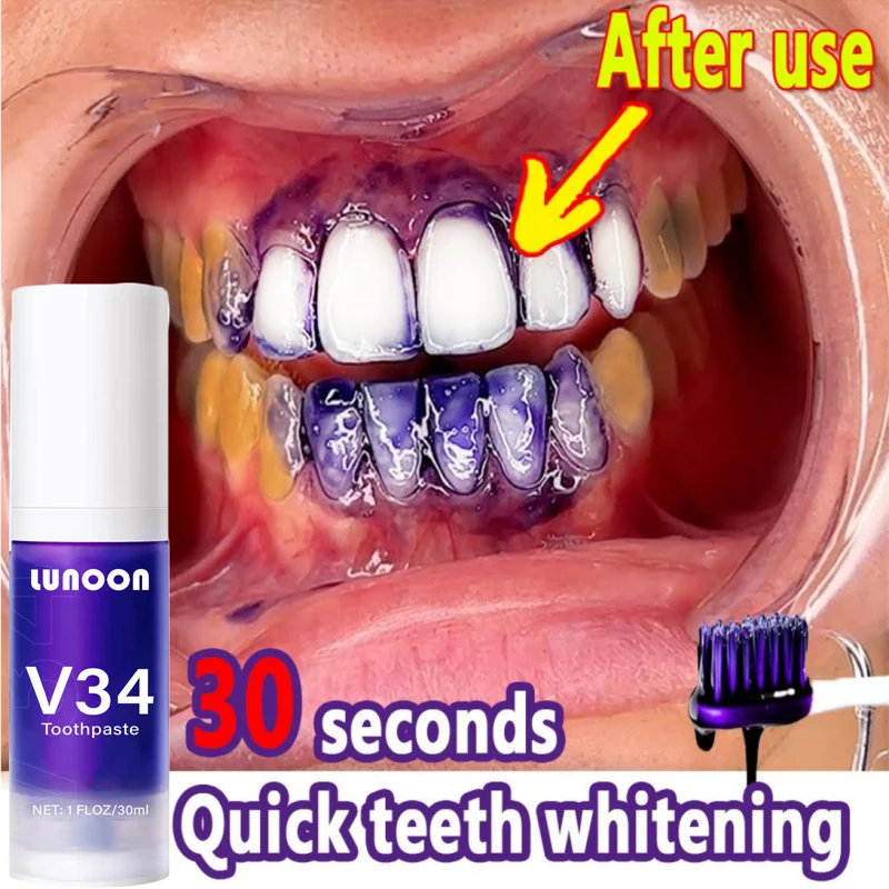 

Teeth Whitening Mousse Toothpaste Remove Plaque Stains Smoke Stains Deep Cleaning Fresh Breath Oral Hygiene Dentally Teeth Care