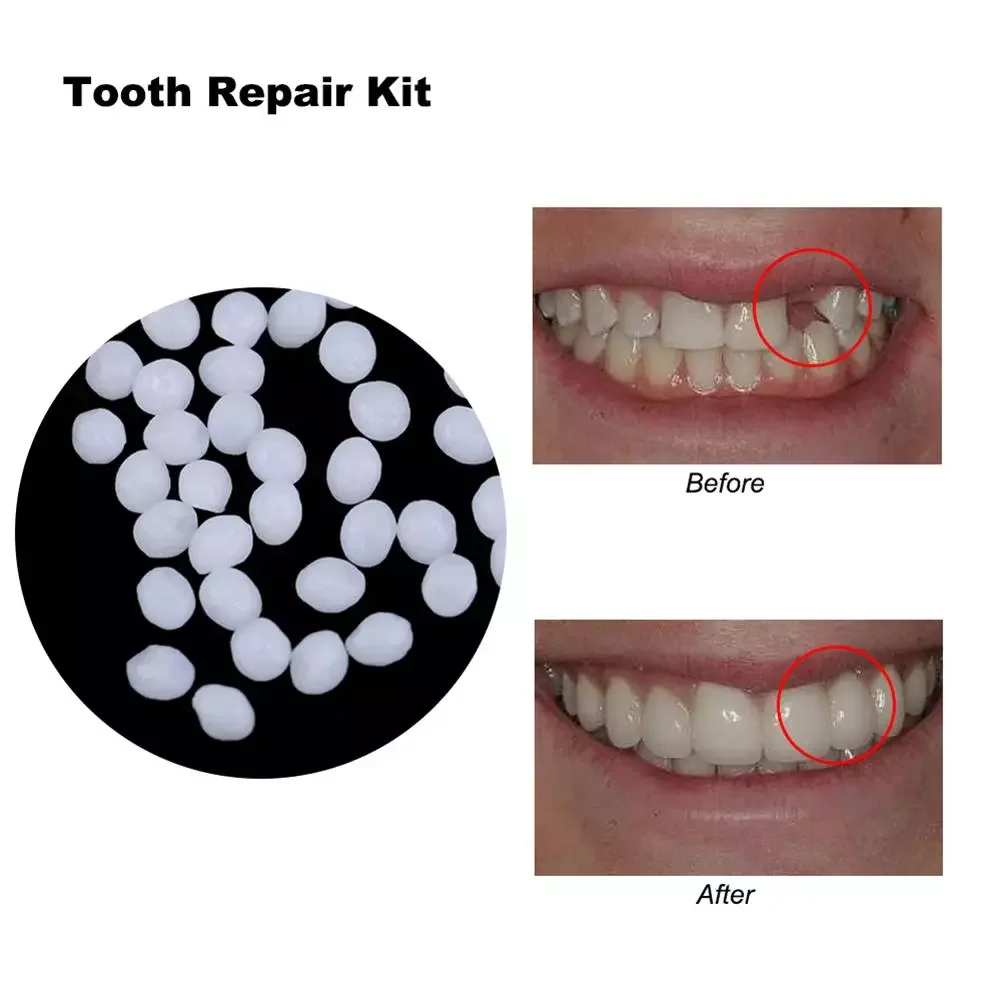 10/100g Φ FalseTeeth твердый клей, набор для временного ремонта зубов, Falseteeth, твердый клей для зубных протезов, клей для зубов, стоматолог
10/100g Φ FalseTeeth твердый клей, набор для временного ремонта зубов, Falseteeth, твердый клей для зубных протезов, клей для зубов, стоматолог