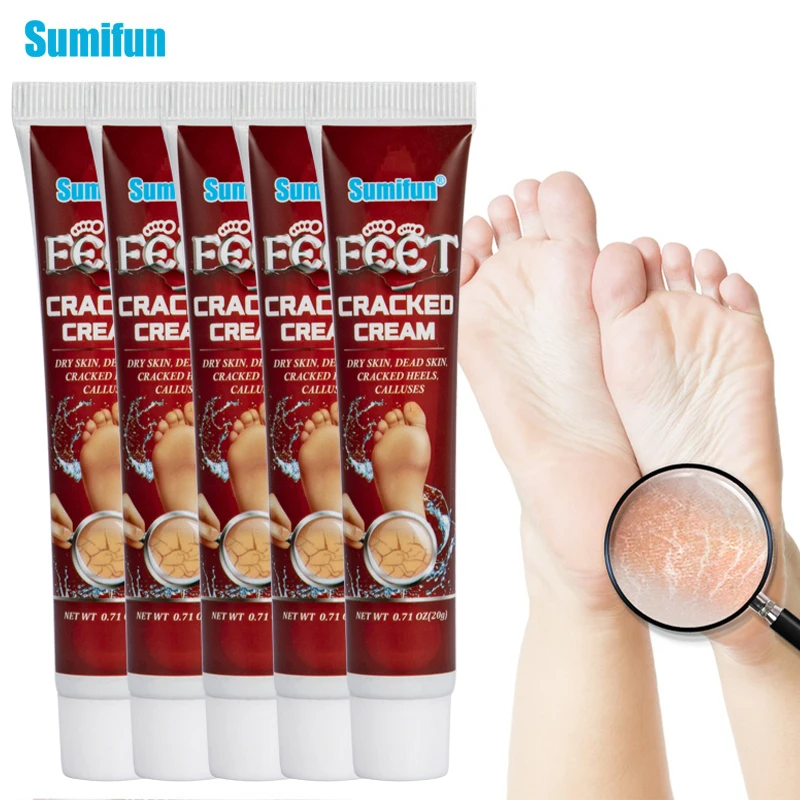 1/3/5 шт., восстанавливающая мазь для ног, 20 г
1/3/5 шт., восстанавливающая мазь для ног, 20 г