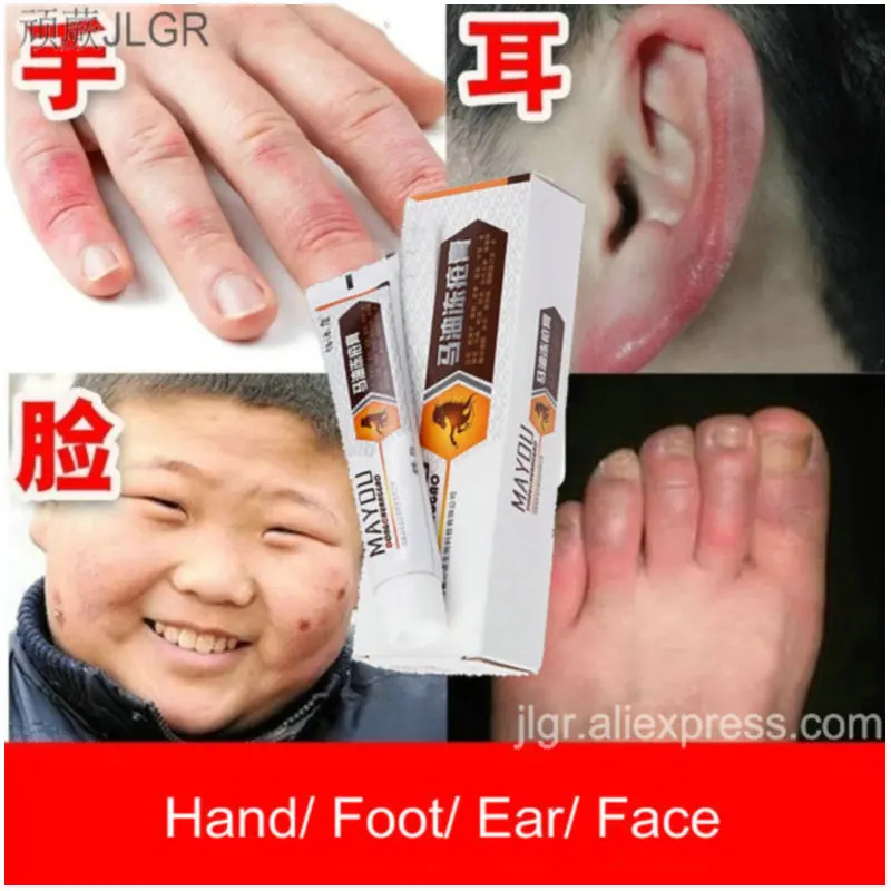 Hand Foot Cream Exfoliant Foot Peel Moisture Hand Lotion Skin Care Creme Bioaqua Hand Cream Serum Antibacterial Cream Hand Care
Hand Foot Cream Exfoliant Foot Peel Moisture Hand Lotion Skin Care Creme Bioaqua Hand Cream Serum Antibacterial Cream Hand Care