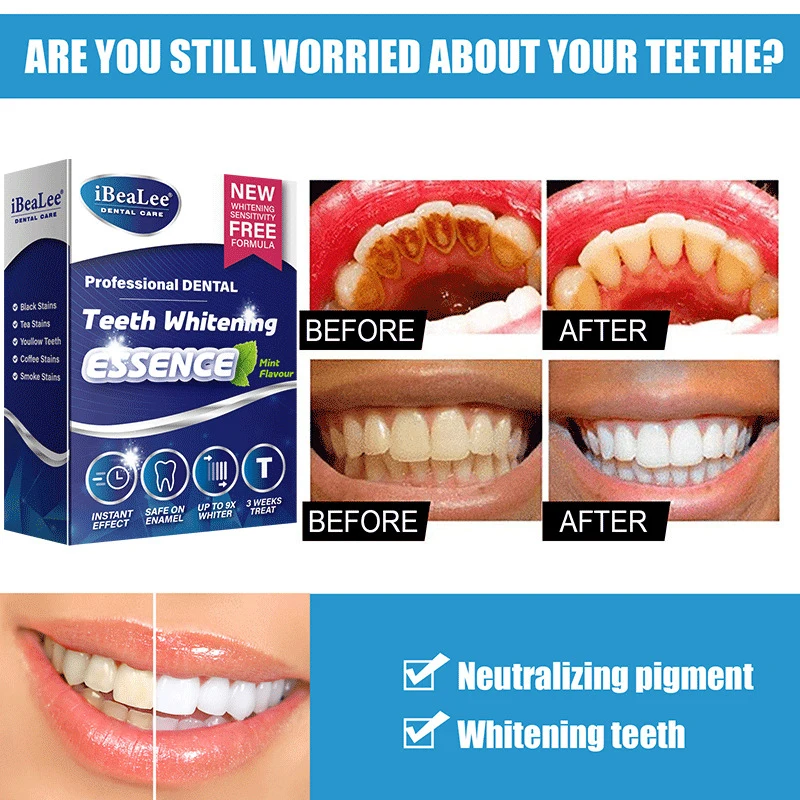 2023 Сыворотка для отбеливания зубов, гигиена полости рта, средство для ухода, отбеливание зубов, отбеливание, удаление пятен от зубного налет...
2023 Сыворотка для отбеливания зубов, гигиена полости рта, средство для ухода, отбеливание зубов, отбеливание, удаление пятен от зубного налет...