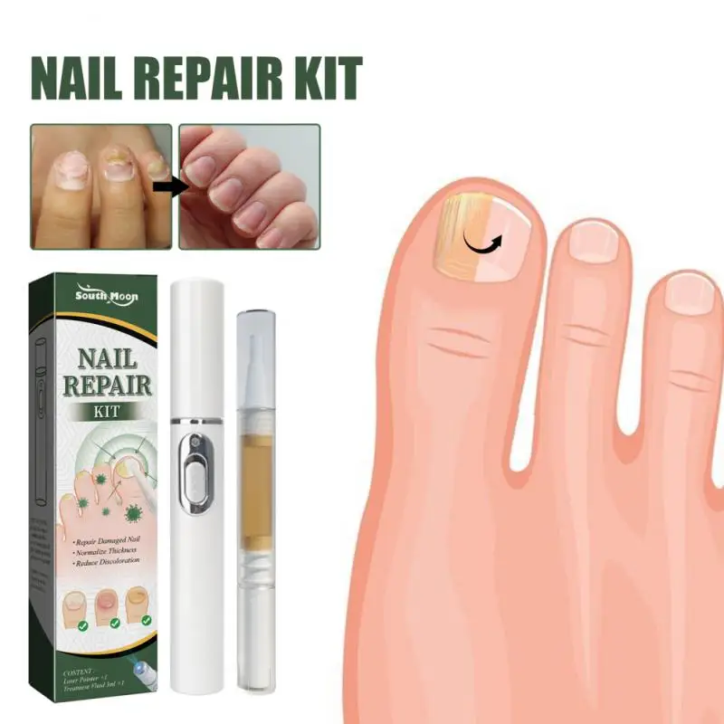 Nail Fungal Laser Pen Nail Repair Set Onychomycosis Killer Anti-infective Hand Foot Grey Nail Repair Liquid
Nail Fungal Laser Pen Nail Repair Set Onychomycosis Killer Anti-infective Hand Foot Grey Nail Repair Liquid