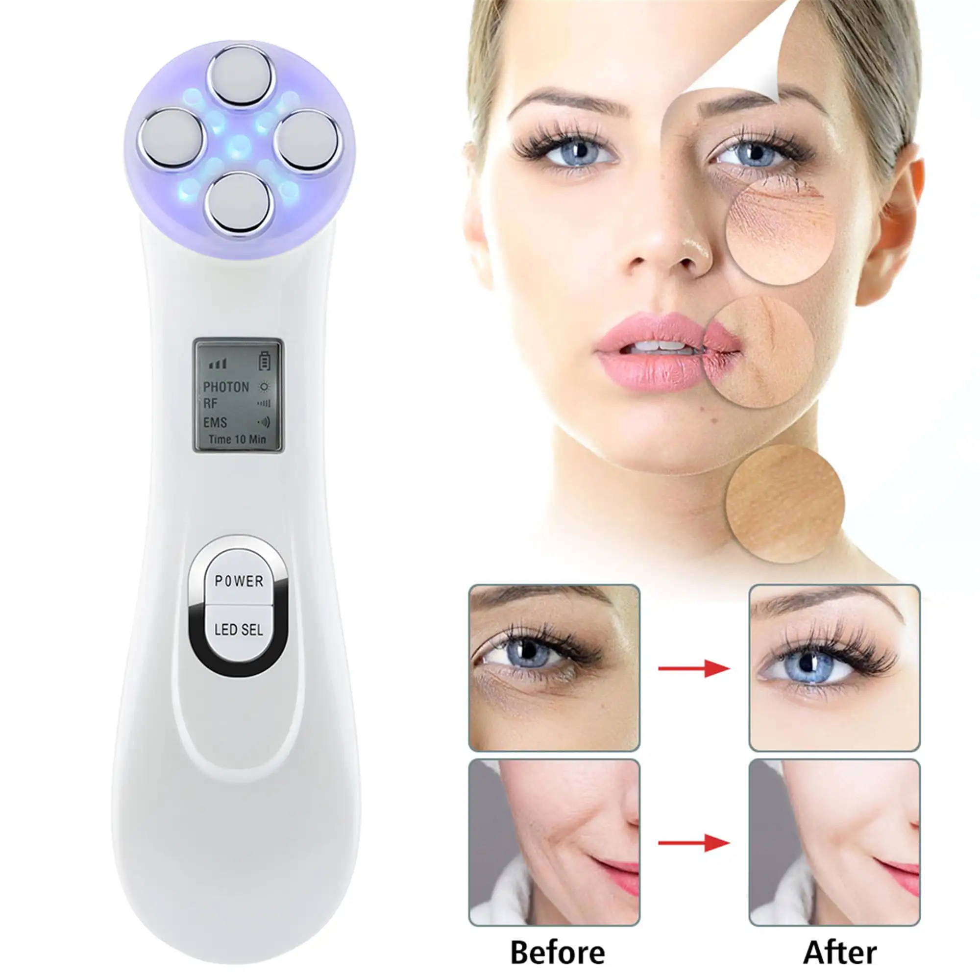 NEW Face Lift Machine - 5 Color LED RF Radio Frequency Facial LED Photon Skin Care Device Face Lift Tighten Beauty Machine USB C
NEW Face Lift Machine - 5 Color LED RF Radio Frequency Facial LED Photon Skin Care Device Face Lift Tighten Beauty Machine USB C