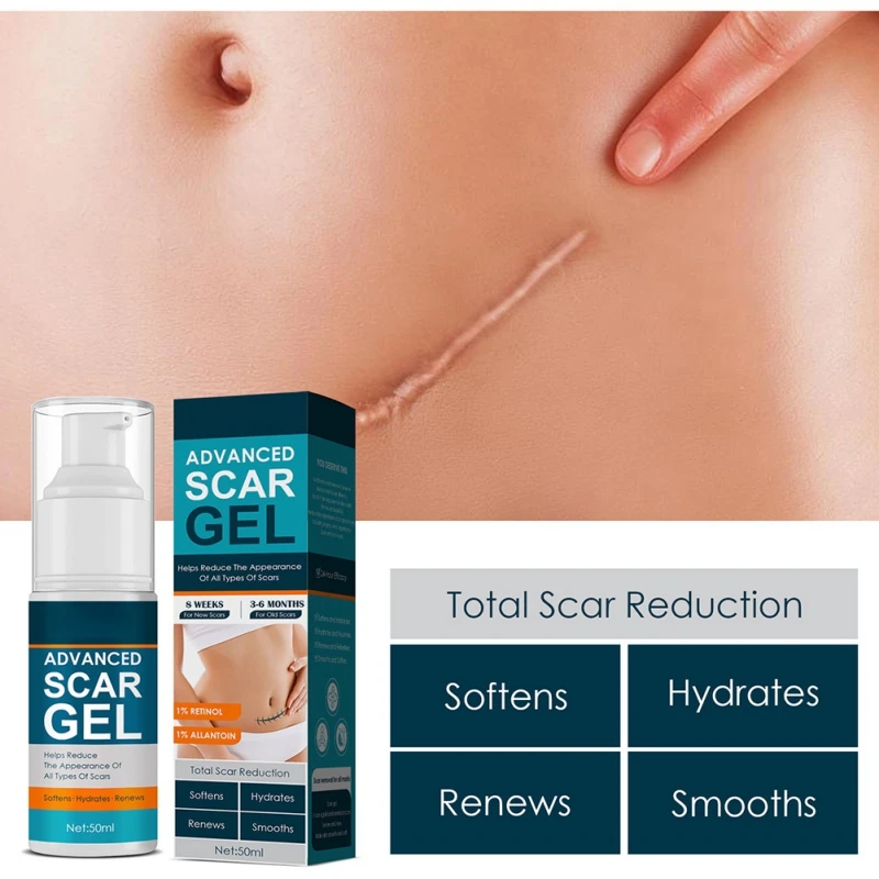 50ml Make Scars Smaller & Less Visible Body Creams Scar Gel for Face Body Skin Care Scar Treatment for Both Old And New Scars
50ml Make Scars Smaller & Less Visible Body Creams Scar Gel for Face Body Skin Care Scar Treatment for Both Old And New Scars
