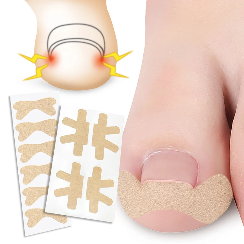 12-4PCS Ingrown Toenail Correction Sticker Adhesive Toenail Patch Toe Nail Treatment Recover Corrector Stickers Foot Care Tool
12-4PCS Ingrown Toenail Correction Sticker Adhesive Toenail Patch Toe Nail Treatment Recover Corrector Stickers Foot Care Tool
