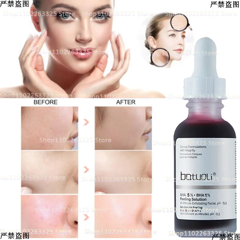 Fruit Acid Salicylic Acid Essence Rejuvenating Skin Anti-wrinkle Anti-aging Essence Improves Blackhead Acne Control Oil
Fruit Acid Salicylic Acid Essence Rejuvenating Skin Anti-wrinkle Anti-aging Essence Improves Blackhead Acne Control Oil