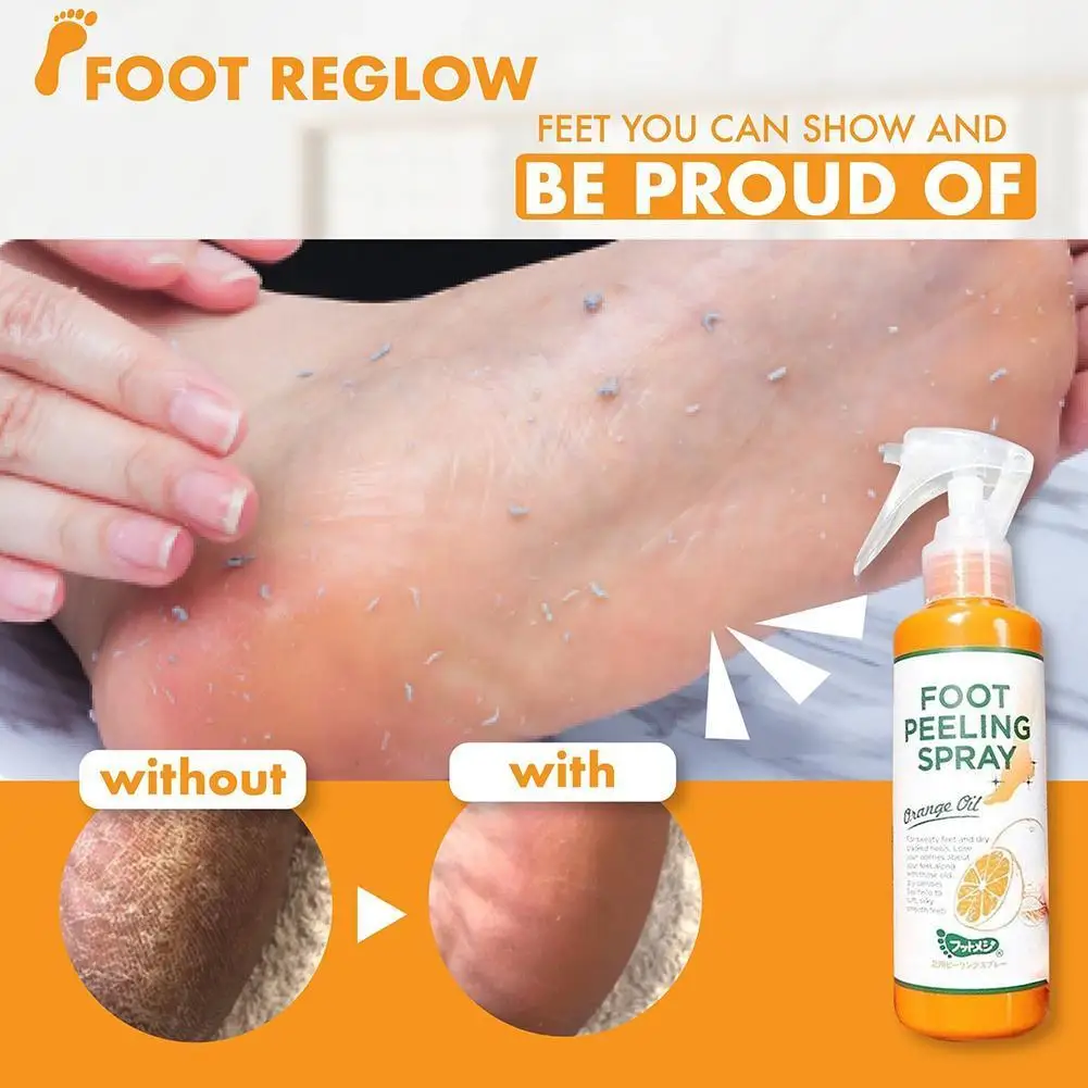 Foot Exfoliating Spray Foot Care Spray To Remove Dead Skin On Feet, Elbows And Knees To Remove Calluses And Crusty Foot 100ml
Foot Exfoliating Spray Foot Care Spray To Remove Dead Skin On Feet, Elbows And Knees To Remove Calluses And Crusty Foot 100ml