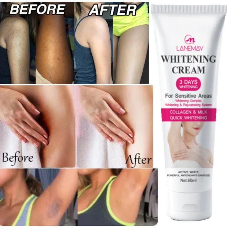 Women's Private Parts Underarm Whitening Cream Brightening Cream Sensitive Parts Whitening and Darkening Armpit Beauty Cream
Women's Private Parts Underarm Whitening Cream Brightening Cream Sensitive Parts Whitening and Darkening Armpit Beauty Cream