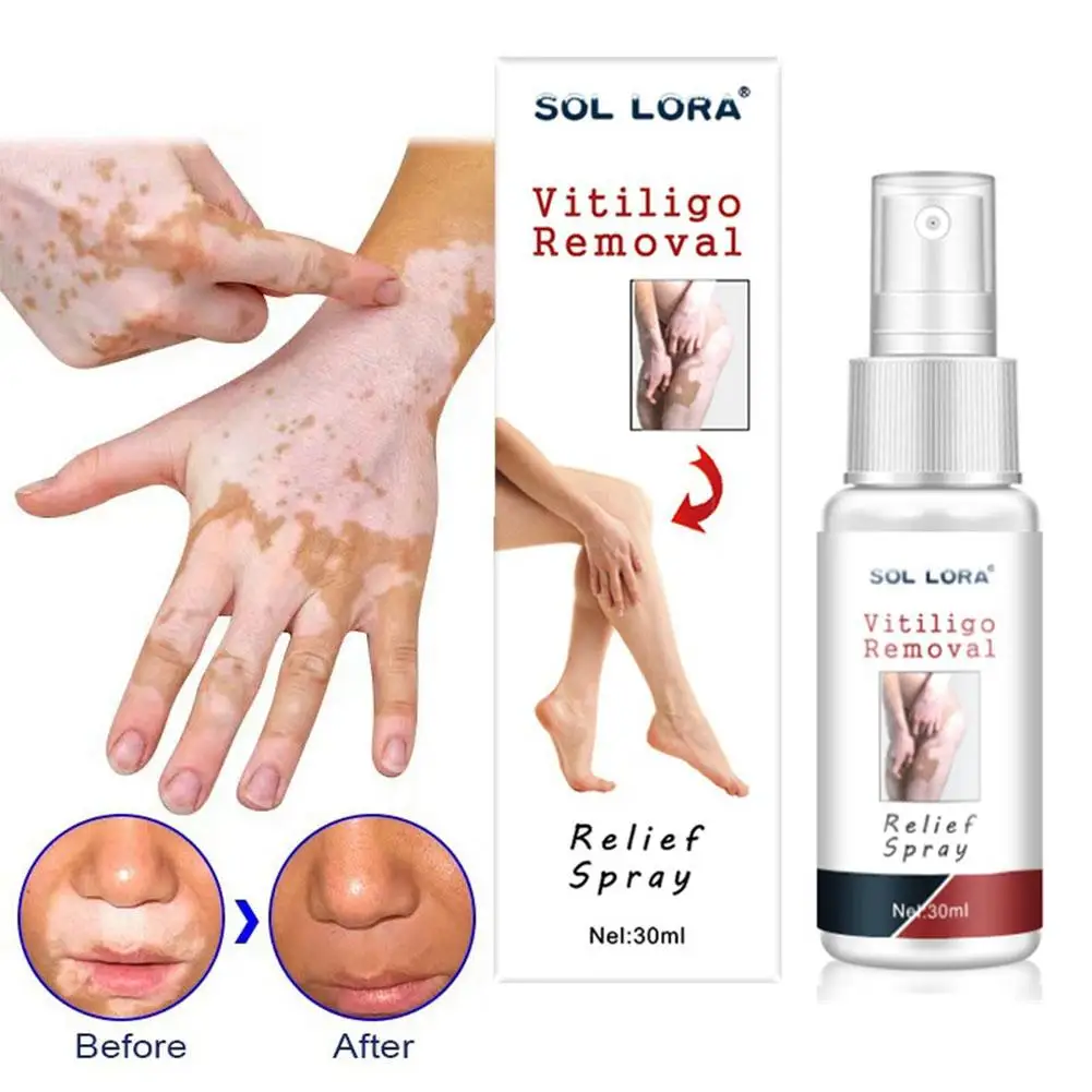 30ml Vitiligo Relief Spray Skin Moisturizing Vitiligo Net Spots Repair Spot Vitiligo Fades Skin White Face Spray Body Repai D5Y6
30ml Vitiligo Relief Spray Skin Moisturizing Vitiligo Net Spots Repair Spot Vitiligo Fades Skin White Face Spray Body Repai D5Y6