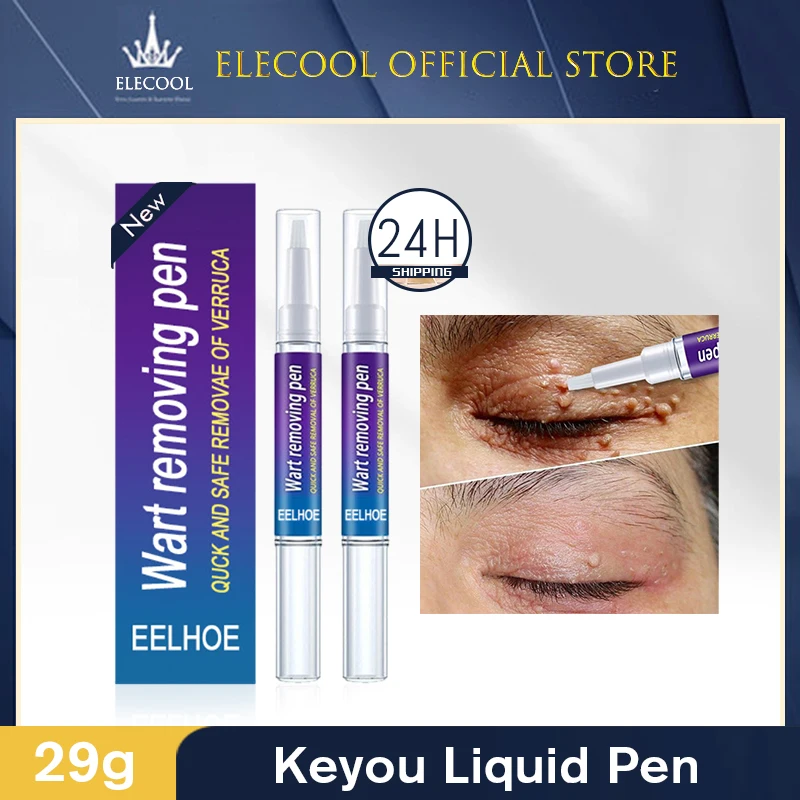 Wart Removal Mole Remedy Liquid Pen Painless Natural plant Skin Tag Cure Removal Body Mole Wart Remover Spot Marks Wart Remover
Wart Removal Mole Remedy Liquid Pen Painless Natural plant Skin Tag Cure Removal Body Mole Wart Remover Spot Marks Wart Remover