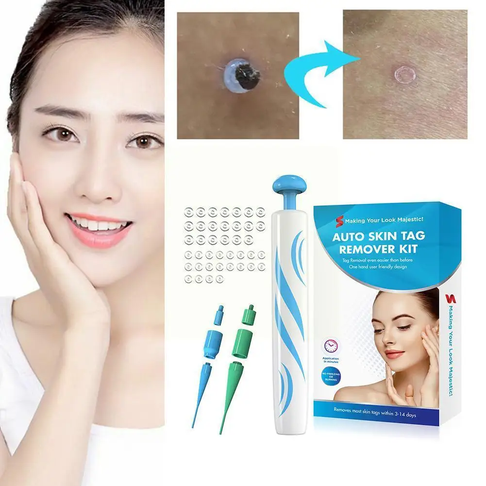 Skin Tag Removing Pen Meat Mole Corns And Wart Removal Stickers Device And Be Repair With It Tools Removal Can Equipped S0f7
Skin Tag Removing Pen Meat Mole Corns And Wart Removal Stickers Device And Be Repair With It Tools Removal Can Equipped S0f7