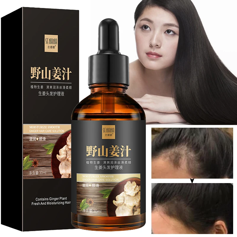 Лосьон для ухода за волосами, восстановление и восстановление волосяных фолликулов, предотвращение выпадения волос, улучшение сушки, вьющи... 
Лосьон для ухода за волосами, восстановление и восстановление волосяных фолликулов, предотвращение выпадения волос, улучшение сушки, вьющи...