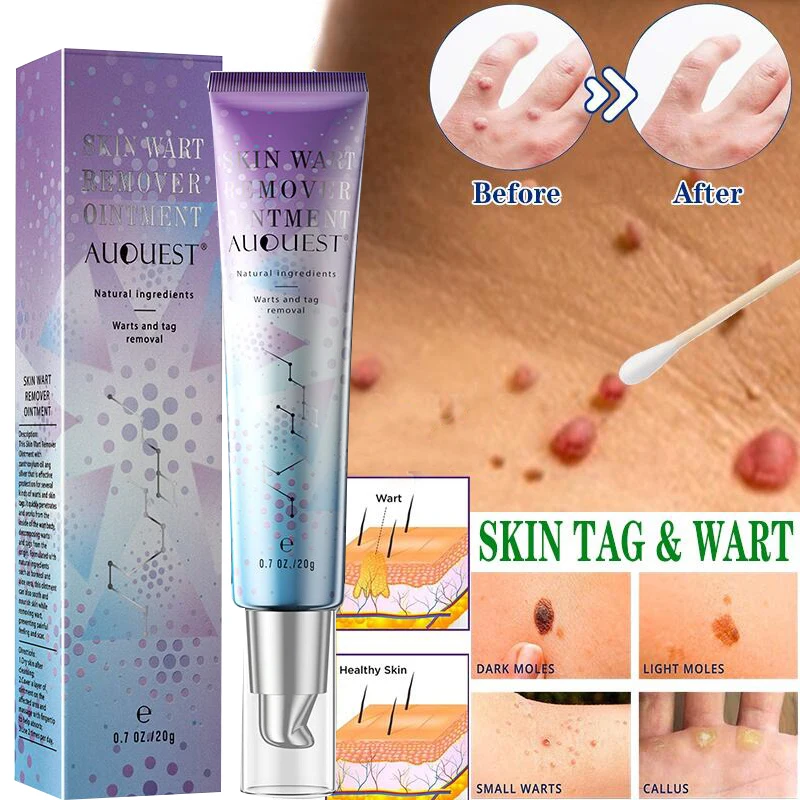 AuQuest Treatment Papillomas Removal of Warts Cream Plantar Genital Wart HPV Mole Skin Tag Remover Ointment Antibacterial Care
AuQuest Treatment Papillomas Removal of Warts Cream Plantar Genital Wart HPV Mole Skin Tag Remover Ointment Antibacterial Care